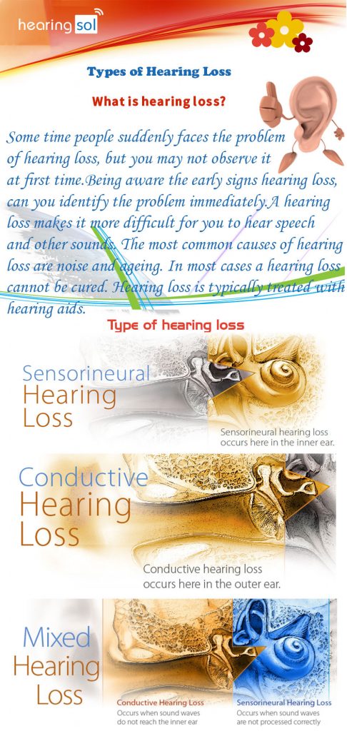 Types Of Hearing Loss - Infographics