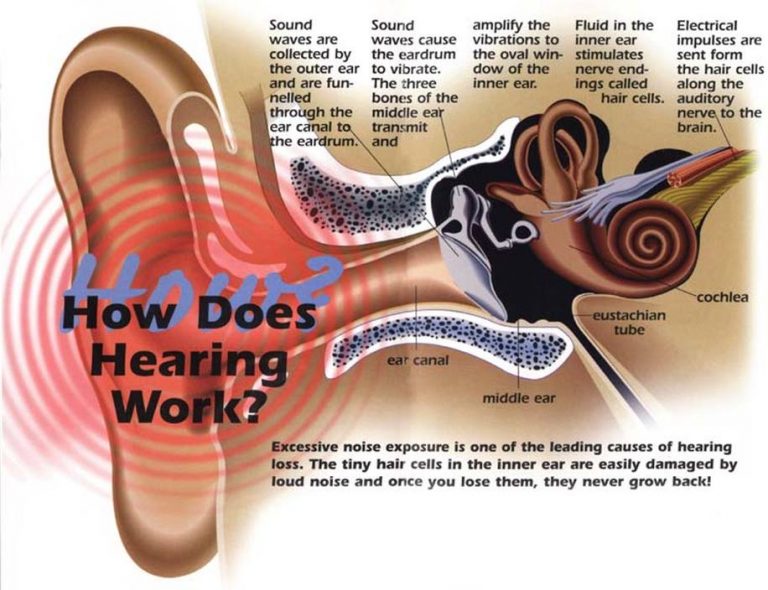 Noise-Induced Hearing Loss (NIHL) | Best Ways To Prevent It