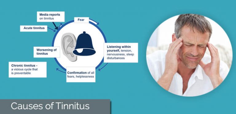 Causes Of Tinnitus New Causes For Ringing In The Ears 2020 2101
