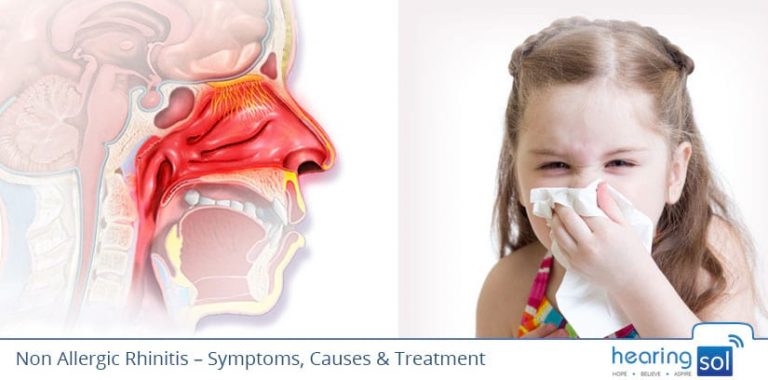 Non Allergic Rhinitis Symptoms Causes And Best Treatment